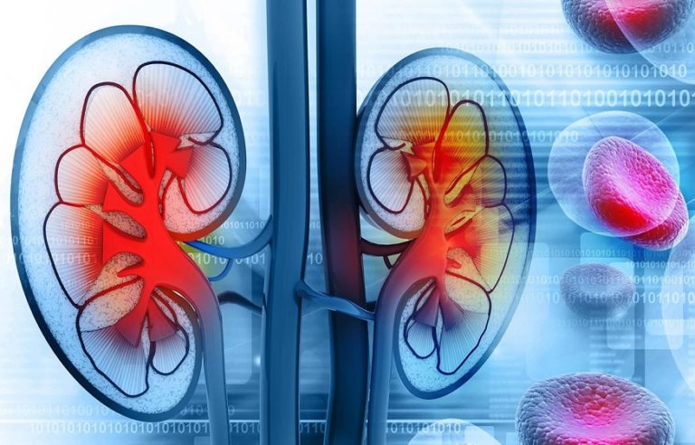 Effects Of Chronic Kidney Diseases On Human Eyes | Momoclomatome.com