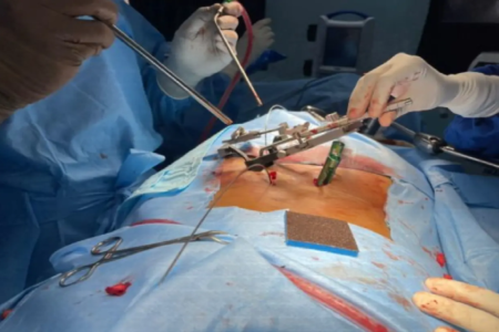 Spinal Surgery